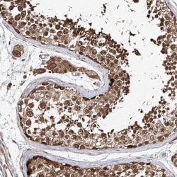 Yes Antibody, Novus Biologicals:Antibodies:Primary Antibodies